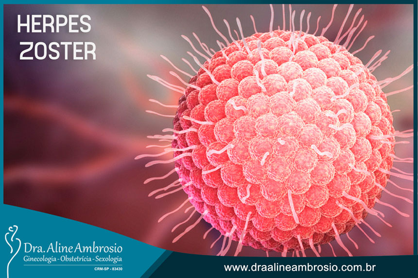 Herpes Zoster - Dra. Aline Ambrosio